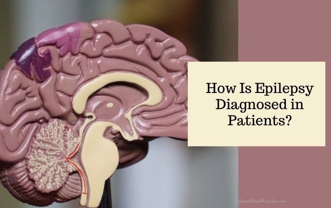 Come viene diagnosticata l'epilessia nei pazienti